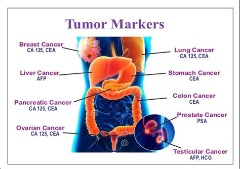 marker tumoral plamani|Profil oncologie (markeri tumorali)